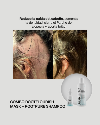 Combo RootLite Shampoo + GlowLite Serum